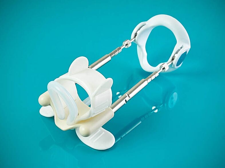 Extension hybride pour un membre