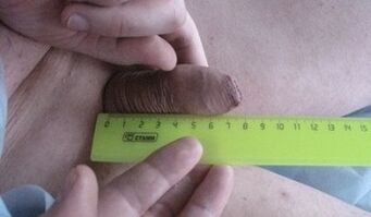 mesure de la taille du pénis